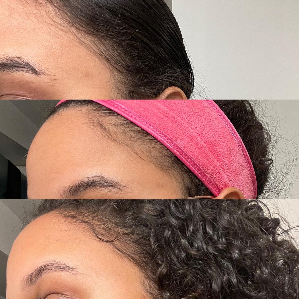 hair growth results in edges in less than 6 months